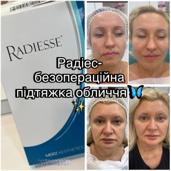 Фото с портфолио Наталья Грицай