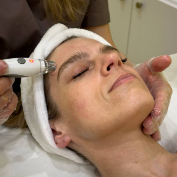 вакуумний масаж обличчя