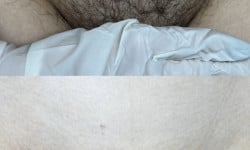 Електроепіляція Электролог (мастер электроэпиляции) Маргарита Киев