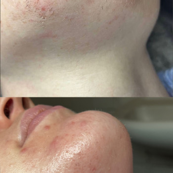 Фото с портфолио Маргарита Бортник