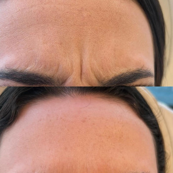 Фото с портфолио Ангелина 