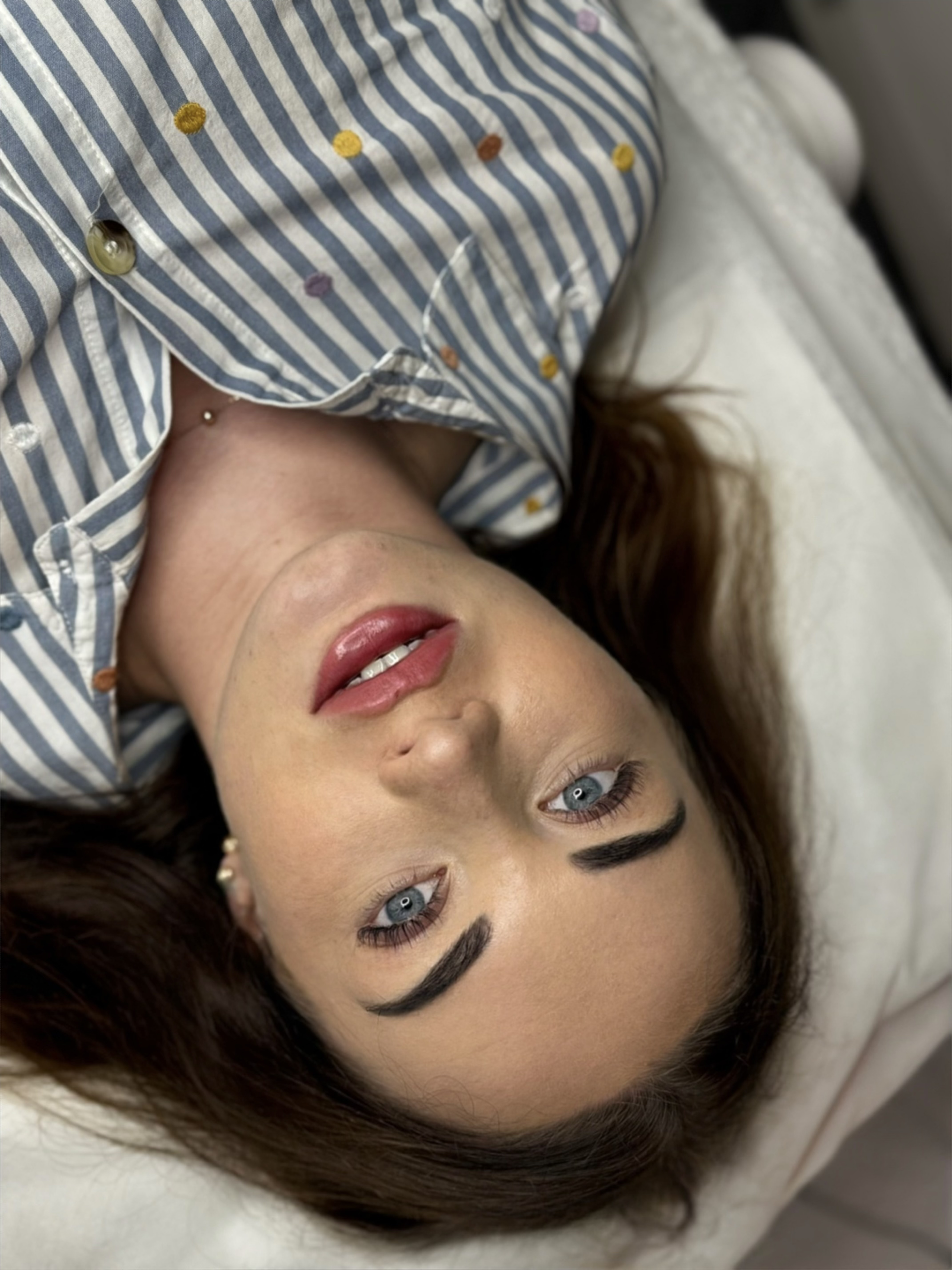 Увеличение губ контурная пластика аугментация, фото - Косметолог Ангелина