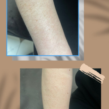 Фото с портфолио Анна Форкун