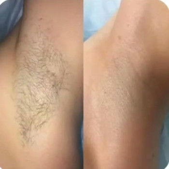 Фото с портфолио Анна Форкун