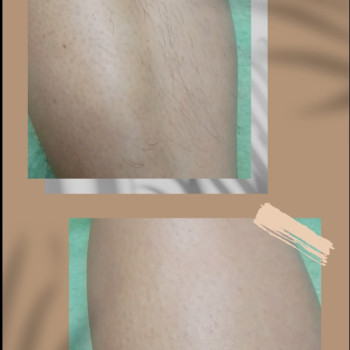 Фото с портфолио Анна Форкун