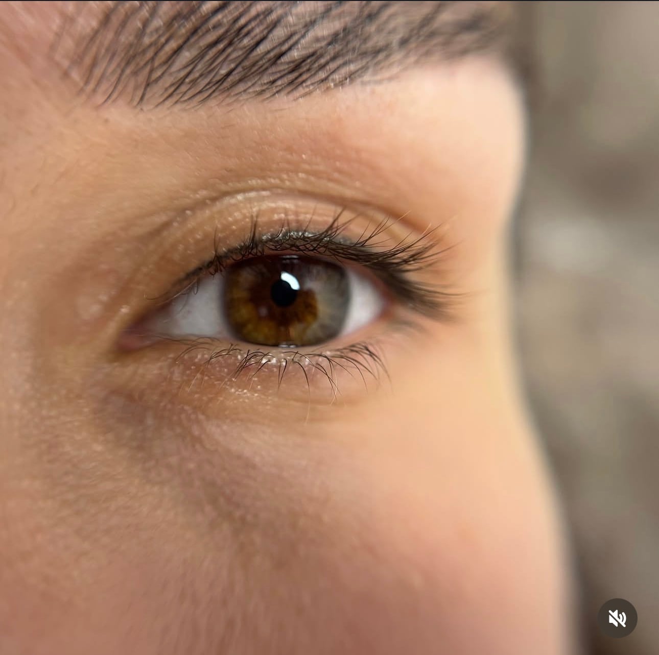 Загоєна міжвійка, фото - Визажист Ирина