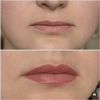 Загоєний перманент губ