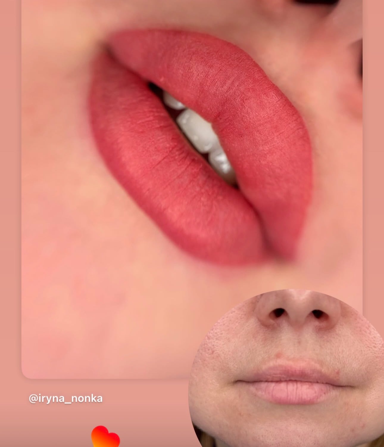 Татуаж губ, фото - Визажист Ирина