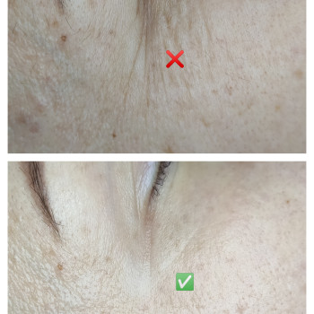 Масаж обличчя від зморшок