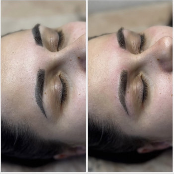 Безпечне видалення сірих брів