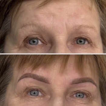 Віковий перманент брів