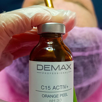 Освітлення пігментаціі