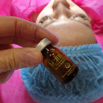 Кемікум пілінг