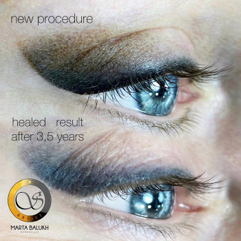 Фото с портфолио Марта Балух