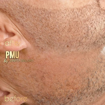 татуажбороди трихопігментаціябороди