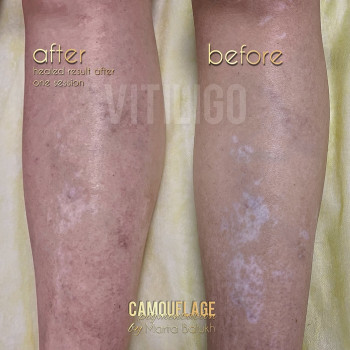 Фото с портфолио Марта Балух