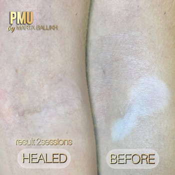 Фото с портфолио Марта Балух