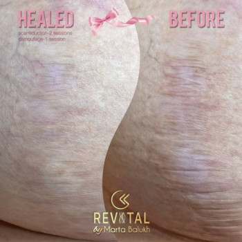 Фото с портфолио Марта Балух