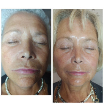 Фото с портфолио Людмила Нестеренко