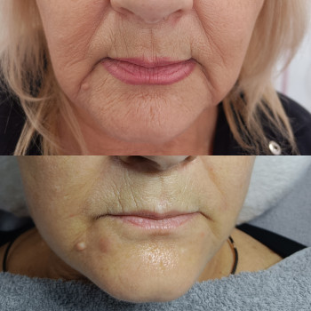 Фото с портфолио Людмила Нестеренко