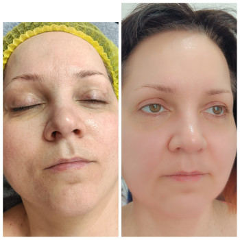 Фото с портфолио Людмила Нестеренко