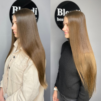 Ботокс до/після