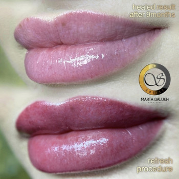 Фото с портфолио Марта Балух