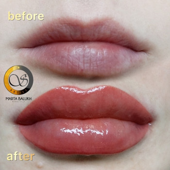 Фото с портфолио Марта Балух