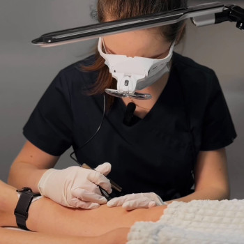 Електроепіляція - видалення волосся назавжди