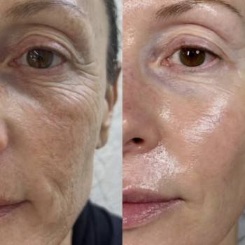 Фото с портфолио Ольга Леус