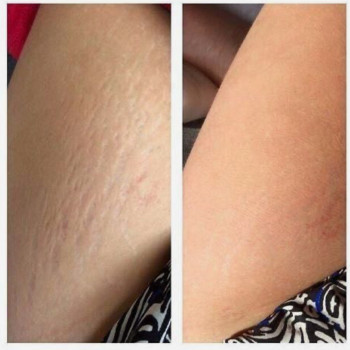 Фото с портфолио Ольга Леус