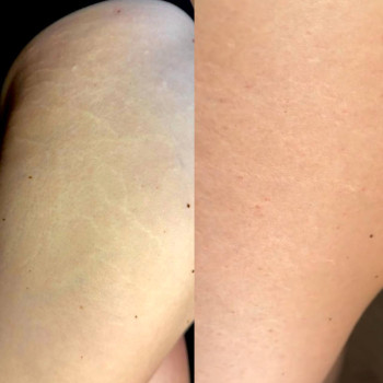 Фото с портфолио Ольга Леус