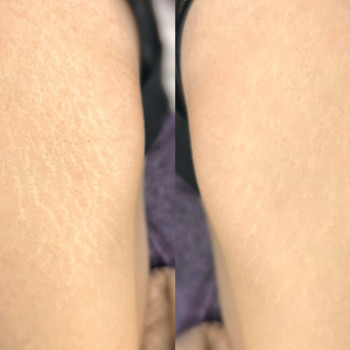 Фото с портфолио Ольга Леус