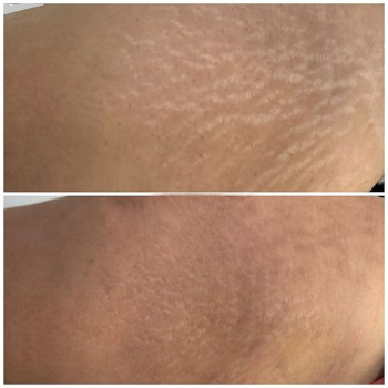 Фото с портфолио Ольга Леус