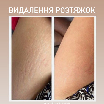 Фото с портфолио Ольга Леус