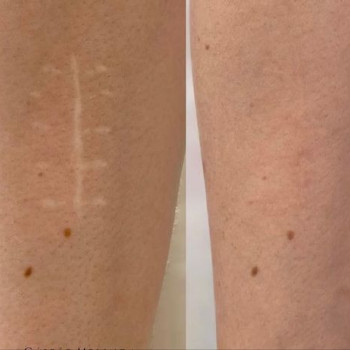 Фото с портфолио Ольга Леус