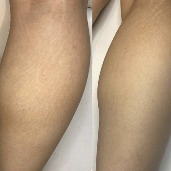 Фото с портфолио Ольга Леус