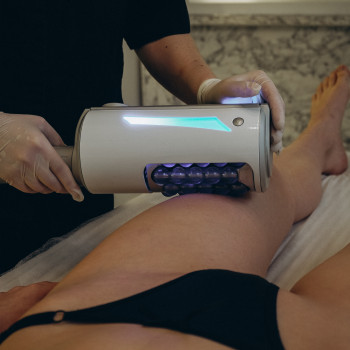 Фото с портфолио Beauty Laser & EndoSpheres Therapy