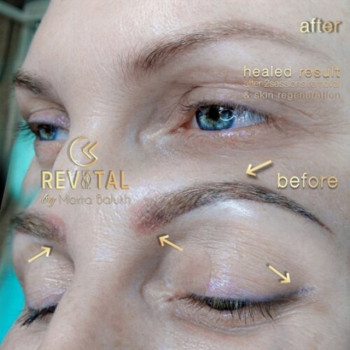 Фото с портфолио Марта Балух