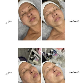 Фото с портфолио Наталя Міріченко