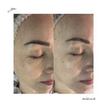 Фото с портфолио Наталя Міріченко