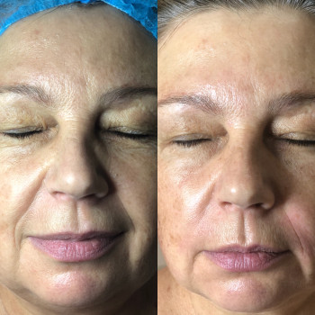 Фото с портфолио Олена Денисова