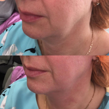 Фото с портфолио Лета Денисова