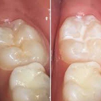 Фото с портфолио Христина Товарянська