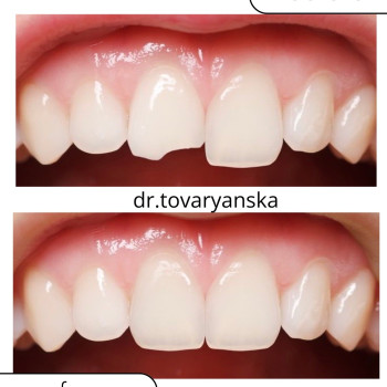 Фото с портфолио Христина Товарянська