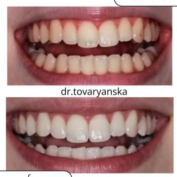 Фото с портфолио Христина Товарянська