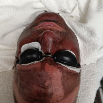 пілінг обличчяшиядекольте