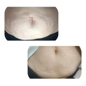 Фото с портфолио Екатерина Дробязко