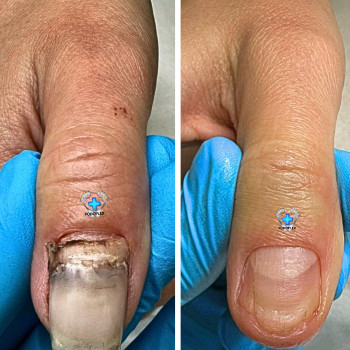 Фото с портфолио Руслана Гончарова