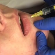 Косметолог-инъекционист Юлия Иванченко на Barb.ua